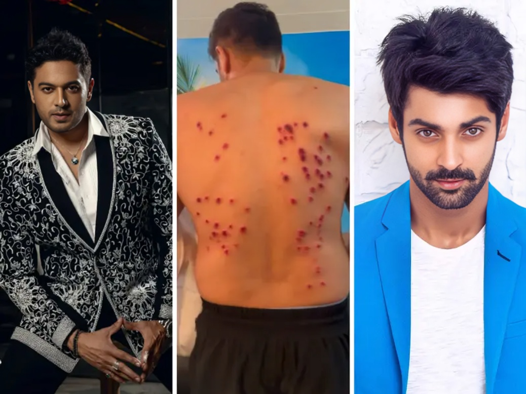 Khatron Ke Khiladi 15: Karan Wahi Opens Up About Controversial Pellet Gun Stunt, Says His Mind Went